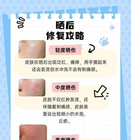 月季被晒伤了该如何处理？